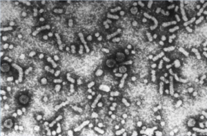 Virus Hepatitis B