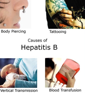 Penyebab Hepatitis B